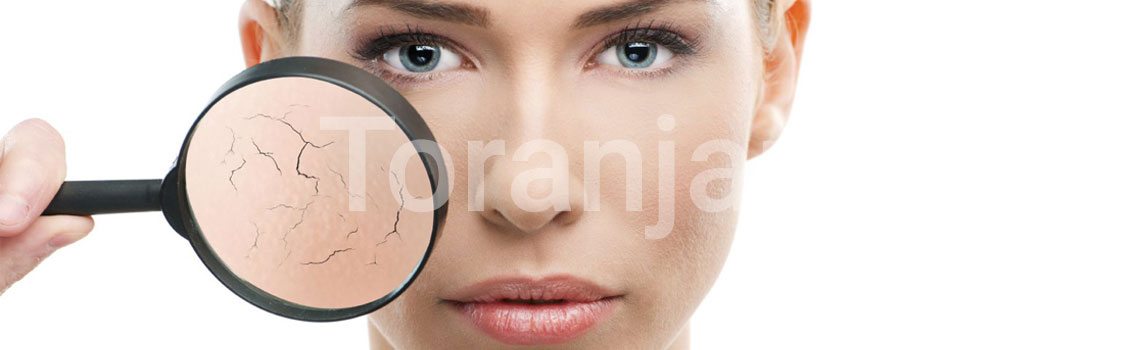 پوست خشک - ترنجان