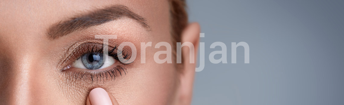 درمانی برای دور چشم - ترنجان
