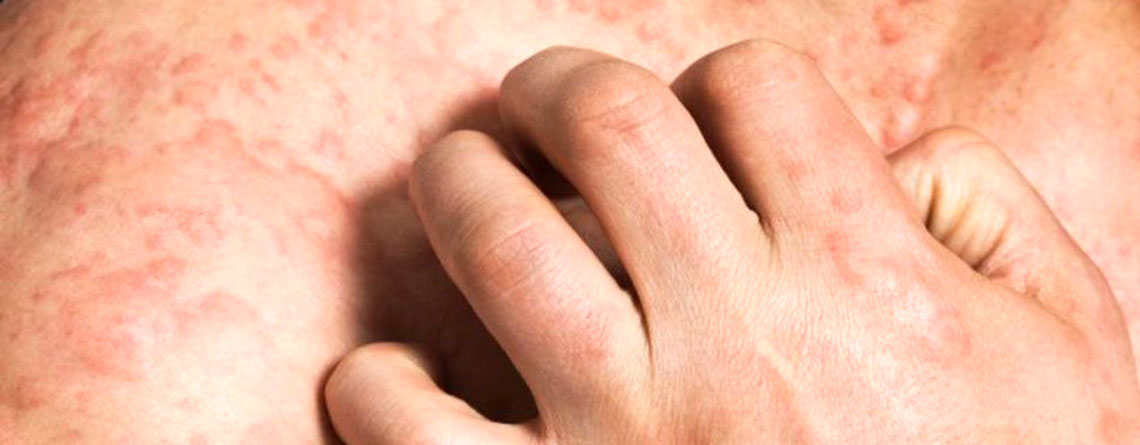 اختلالات پوستی شایع - بخش اول - ترنجان